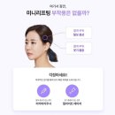 유브의원 | 부산 슈링크리프팅 아닌 미니리프팅 받은 솔직후기