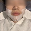 람스킨케어 | [부천/신중동] 람스킨케어 _ 여드름재생관리 후기/신중동피부관리