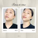 장기동 | 김포 장기동 피부관리 후기(3일 만에 기미·주근깨 옅어진 방법)