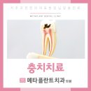 메타플란트치과의원 이미지