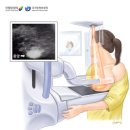 위아래내과의원 | 유방초음파 &amp; 찌부검사(유방엑스레이) 후기 / 통증, 실비, 물혹 발견..😦