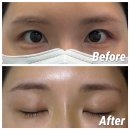 눈썹살롱 | 서면눈썹전문샵 눈썹살롱 잔흔제거 후기｜부산잔흔제거 잘하는 곳 추천!