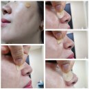 터치피부샵 이미지