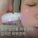 김지안뷰티 | 울산 삼산동 피부관리 김지안 피부관리 써마지 에스테틱 탄력 리프팅 가성비