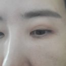 성원장 | ❤️ 플랜유 성원장의 셀프 시술 후기 ❤️