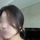 홍대 피부과 | 필러카세 옆볼 뉴라미스, 코옆 콜라움240 후기, 전후비교!