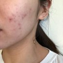 일주일에 한 번 저자극 각질제거팩 바게지 스폰지마스크
