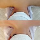 다올한의원 | 도룡동 ‘다올에스테틱’ 피부관리 알포유에너지테라피 자세교정 전후차이 대박 👍🏼