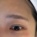 운정역 | 스킨솔브 메디슈티컬 운정역점ㅣ파주 여드름, 피부관리 후기