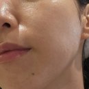 천인카 | 어바니카 온그린테라피 마스크팩추천,레이저 후 예민해진 피부 응급 진정 후기