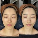 아마릴리스뷰티 | 마곡 에스테틱 아마릴리스 뷰티 :: 본식전 웨딩관리 후기! feat.땅콩형 얼굴