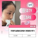 지앤지성형외과에서 변화된 후기