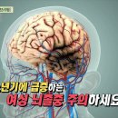 [무엇이든 팩트체크] 1) 술·담배 안 하는데 여성 간암·폐암 환자 급증 2) 뇌혈관 망가진 여성도 급증! ... 이미지