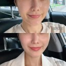 메디칼 세븐(7) | 창원 시티세븐 7층 피부과 기미 잡티 레이저 피코토닝 제네시스토닝 후기