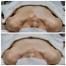 힐링 스파 이미지