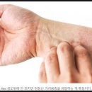 옴 이미지