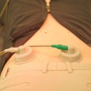 에스본한의원 이미지