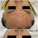 아임스킨