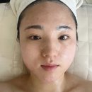 (주)제이온 | 대전 도안동피부관리 하이푸라이팅 V윤곽관리 후기 &#39;제이온뷰티&#39;