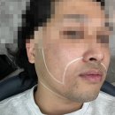 맑은윤피부과의원 | wedding #2 예랑이의 인생 첫 피부과 방문..