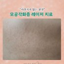 흔이나게