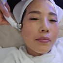 JS스킨케어 - 사천시 | 울산 피부관리 데자뷰메디스킨 울산점 윤곽케어 후기