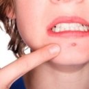 피브엔의원 이미지