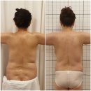 광양 피부관리 : &#39;알포유&#39;로 아픈 다리 관리 후기~!