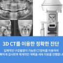 올바른 치과기공소 네이버블로그