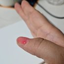 엄지손톱화장품 | 그냥 두면 고생길! '오호라 내추럴 글로우 스트로베리' 내돈내산 손톱 강화제 후기 및 손톱영양제 비교