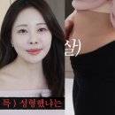 스포츠조선미디어주 | 아옳이 50kg 찍고 비상, 불룩 뱃살 공개 후 "얼굴 필러 느낌" 고백으로 화제