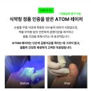 송도센트럴정신건강의학과의원 | 문제성 발톱, 전문적인 치료가 필요합니다 | 닥터디자이너의원 송도점 문제성발톱클리닉센터