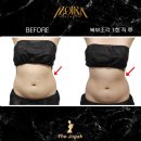 [공지] 복부 라인 교정 + 피부 탄력까지! 수원 복부관리 전문샵