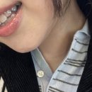 두번째