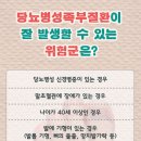 발관리 이미지