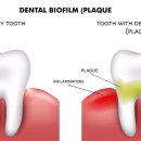 이75덴탈 이미지