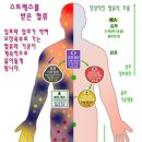 뇌졸중의 예방과 치료 이미지