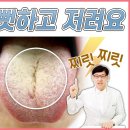 손발저림 원인과 증상 치료에 좋은 약초는? 이미지