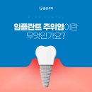 플란부평