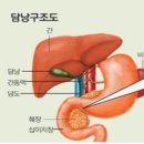 담도암 이미지