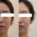 백의민족 | 미사피부관리 | 백의민족피부 하남미사점 | 안면...곳! 작은얼굴발굴 &amp; 오아시스 관리 예신관리 후기