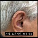 포낙보청기 송파방이센터 이미지