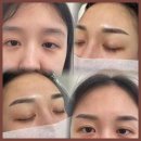 윤메디케어 | 가평속눈썹 가평에서 찾은 효과적인 메디케어, 윤이나다