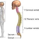 측만증[scoliosis] 이미지