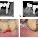 휴플란트치과의원 이미지