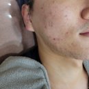 헤바스킨앤바디 이미지