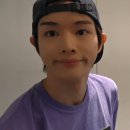 양이멍이 | 팔 무한람스 1주차 후기 (붓기, 멍, 통증, 뭉침..)