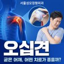 이을정형외과의원 | 남성역정형외과 오십견으로 인한 굳은 어깨, 어떤 치료가 좋을까?