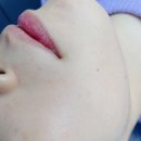 호평동 마벨르뷰티에서 스킨플래닝 후기! 부작용없이 깐달걀 피부관리 효과 나왔을까?