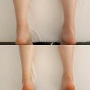 용인 죽전피부관리 오늘동안 하체관리 후기